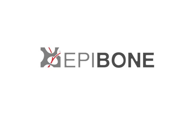 شركة EpiBone تحصل على تمويل جديد بقيادة Kendall Capital Partners